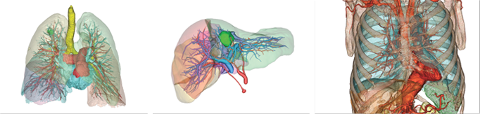 Ziosoft clinical images